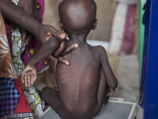 Hardship: Nigerian govt confirms over 4m children malnourished in Northeast, Northwest