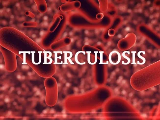 We relegated Tuberculosis diagnosis, treatment - Bauchi govt pledges more funding