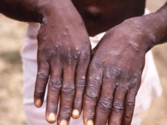 Mpox: Eight new cases confirmed - NCDC