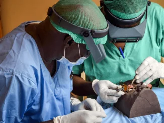 3,000 Beneficiaries Get Free Eye Surgery In Kano