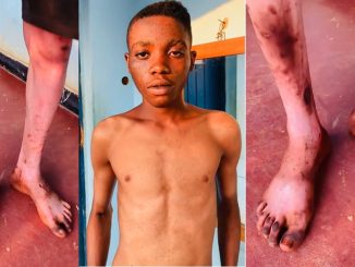 Man leaves online viewers dúmbstruck with astonishing skin transformation (VIDEO)