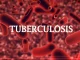 Leveraging Partnerships, Innovation To End Tuberculosis In Nigeria