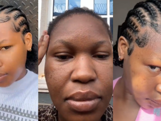 Lady súffers from face rashes after keeping braids in for 10 weeks (WATCH)