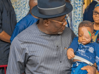 21 months after, NDLEA abandons family of 2-year-old toddler killed, as survivor risks blindness
