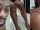 Photos show injuries sustained by NANS president after alleged attack by Seyi Tinubu’s thugs