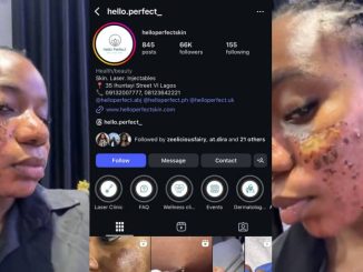 Clinic allegedly vows to jail lady for speaking out after acne treatment results in permanent scar